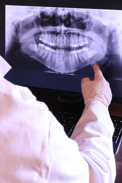 Best Emergency Tooth Extraction in Platte, SD