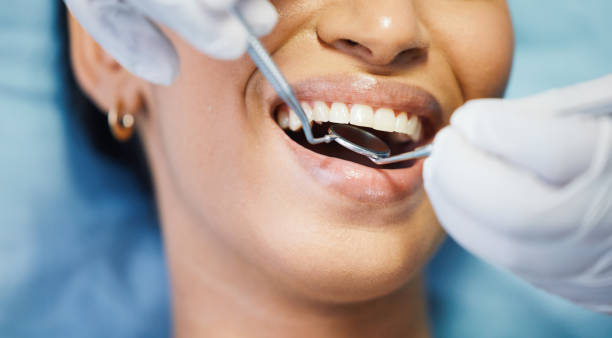 Best Emergency Dental Care for Broken or Chipped Teeth in Platte, SD